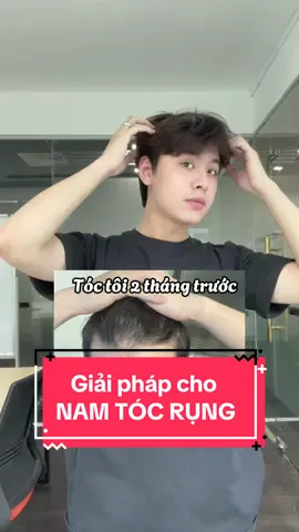 Ông nào tóc rụng sắp h…ói thì xem ngay #labnature #d#daugoinamg#giamrungtocD#DauGoiLabNatureMenmenhairloss  