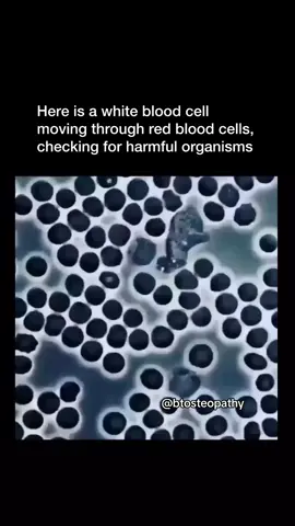 What do white blood cells do?⤵️ . ✅ If you find this information interesting, follow @btosteopathy for more.  . There are several types of white blood cells, each with specific functions: . 👉🏼 Neutrophils: They are the most abundant type of white blood cells and are essential for fighting bacterial infections through phagocytosis. . 👉🏼 Lymphocytes: There are two main types: T cells and B cells. T cells are involved in cell-mediated immunity, including attacking infected cells and coordinating immune responses. B cells produce antibodies that target specific pathogens. . 👉🏼 Monocytes: They are large white blood cells that can differentiate into macrophages or dendritic cells, both of which are involved in phagocytosis and antigen presentation. . 👉🏼 Eosinophils: They play a role in allergic reactions and defense against parasites by releasing toxic granules. . 👉🏼 Basophils: They release histamine and other chemicals involved in inflammation and allergic responses. . White blood cells, also known as leukocytes, are a crucial part of the body’s immune system.  . They are produced in the bone marrow and circulate throughout the bloodstream and lymphatic system.  . White blood cells help the body defend against infections and foreign invaders by identifying and destroying pathogens such as bacteria, viruses, and other harmful substances. . The human body has what it needs to self heal and self regulate as long as all parts are working correctly. . #immunesystemsupport #immunefunction #immunesystemhealth #immunehealth #whitebloodcell #naturalhealing #naturalhealthtips #humanbody #osteopathy #osteopathictreatment #manualtherapy #btosteopathy