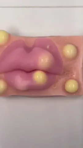 Lips acne removal mochi pimple poppimg satisfying asmr video Satisfying??  #asmrsounds #asmr #viral #fypシ #relax #skincare #mouthsounds #satisfying #tingles #asmrtriggers #mochipimplepopping #pimplepoppin #acnetreatment #asmrtiktoks #asmr_tingles #asmrvideo #lips 