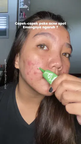 btw ini ada sensasi dinginnya, enak dipake dijerawat meradang #acnefighter #acneskin #obattotoljerawat #youacneplus #jeratjerawat @YOU Beauty Indonesia 