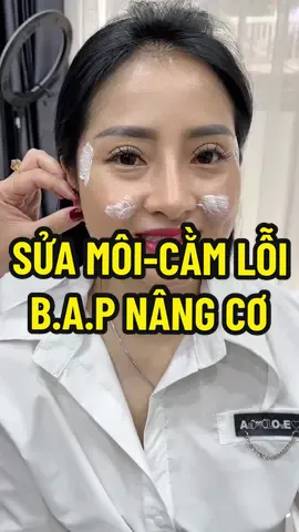 Tình trạng tiêm quá nhiều gây dãn da môi và tiêm cằm quá nhọn .. SAU KHI CÂN CHỈNH KHUÔN MẶT ĐẦY ĐẶN VÀ HÀI HOÀ CÙNG DỊCH VỤ TIÊM BAP NÂNG CƠ TRẺ HOÁ #xuhuong #BAP #tiêm_cằm #tiêm_môi #nganfiller 