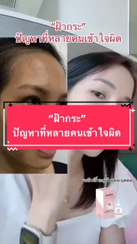 #ฝ้ากระ ปัญหาที่หลายคนเข้าใจผิด #ลาออร์ #เทรนด์วันนี้ #รีวิวบิวตี้ #รีวิวของดีบอกต่อ #คลั่งขาว #ผิวแพ้ง่าย #44สาดโปรดีลดับร้อน #tiktokshopช้อปกันวันเงินออก #หลุมสิว #รูขุมขนกว้าง #ฝ้า #สิว #ริ้วรอย #รอยแดง 