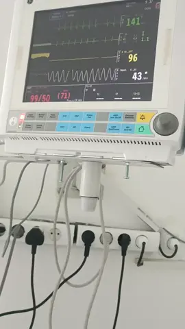 Bedside monitor adalah suatu alat yang digunakan untuk memonitor tanda- tanda vital pasien, berupa nadi, tekanan darah, temperature, kadar oksigen dan frekuensi pernapasan secara terus menerus. Info lengkapnya Cek Youtube..  SEMOGA INFONYA BERMANFAAT & SALAM SEHAT..!!