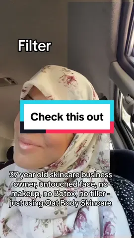 Game changer for the skin #filtervsreality #filtervsnofilter #fyp #foryourpagе #foryourpagetiktok #myskin #myskinandme #skincareroutine #skincarebusiness #tiktokmademebuyit #tiktokvideos #skincareroutine #skincareregimen #skincareviral #skincareproducts #allnaturalskincare 