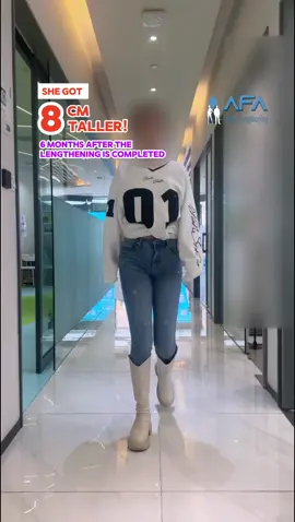 SHE GOT 8 CM TALLER! 👏🏻 PRECICE 2 FEMUR  157 CM >> 165 CM  #afalimblengthening #limblengtheningsurgeryturkey #limblengtheningsurgery #limblengthening #heightincrease #leglengtheningsurgery #leglengthening #gettaller #tik_tok #keşfetteyizzz #tiktokviral #keşfet 