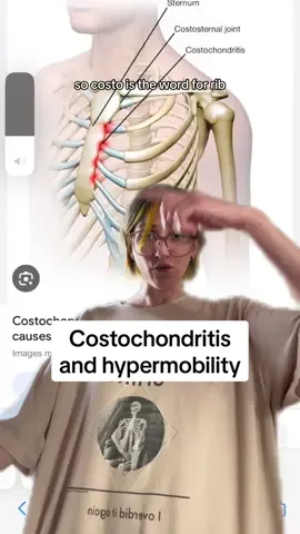 Replying to @Fyren costochondritis is common in hypermobile people. #Hypermobility #Costochondritis #HypermobileEhlersDanlosSyndrome 