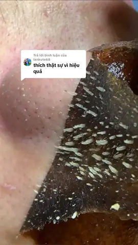 Trả lời @lankute68  Gel Lột Mụn Đầu Đen Lucky Star Lột Lột Đến Đâu Sạch Sâu Tới Đó  #gellotmunluckystar #lotmunthanhoattinh  #mundauden #lamdep #matnalotmun #thinhhanh #xuhuong 