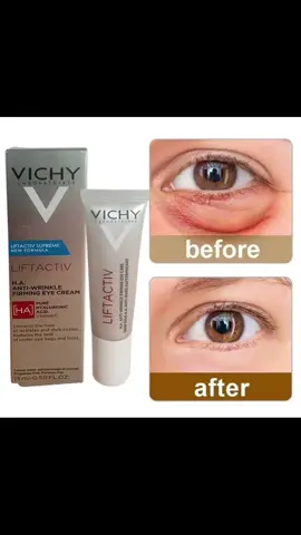 #vichy #eyecream #nowrinkles #nodarkcircles 