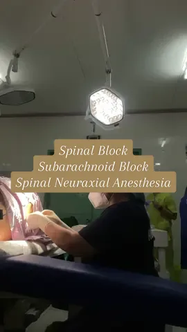 Subarachnoid Block/Spinal Neuraxial Anesthesia/Spinal Block for Surgeries involving lower abdomen and lower limbs. This video was taken and posted for educational purposes only with the patient's consent provided that no details about the hospital, the procedure, its date and time and any information that may lead to the identity of the patient be disclosed. #anesthesia #spinalanesthesia #anesthetist #anesthesiologist #medical #medicalstudent #nursingstudent #doctor #fyp 