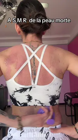 C’est l’ASMR parfait de la peau morte #asmr #asmrsounds #asmrvideo #psoriasis 