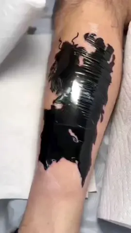 A recent viral video has caused panic showing ink trapped under the skin #tattoos #tattoo #fyp 