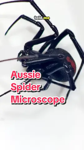 Do not touch this Australian Spider! #spider #microscope #redback #spiderman #dangerous #venom #scary #Science #STEM #closeup 
