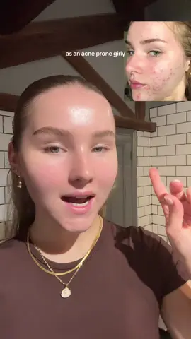 acne prone skin 🤝🏼 hydrating toners product mentioned: Tir Tir Milk Skin Toner I got this toner from @Skin Cupid (K-Beauty Shop) ad and code MILLIETIR10 will give discount! #acne #acneproneskin #clearskin #skincare #skincarerecommendations #koreanskincare #skintok #fyp #explore 