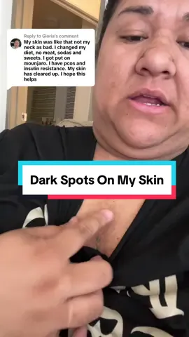 Replying to @Gloria  my skin journey has been a rollercoaster ride. So many insecurities that i am now facing as an adult and its so healing #insulinresistance #pcos #darkneck #darkarmpits #darkskin #skindiscoloration #darkchest #skinissues #polynesian #samoantiktok #polytiktok #polytiktok🇦🇸🇼🇸🇹🇴🇫🇯 #fyp #viral #trending 