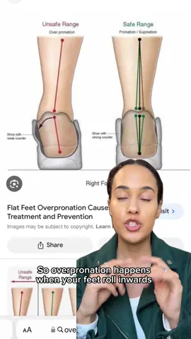 🚨The unsupportive insoles in your shoes cause foot, knee, & back pain 🚨  Fulton's cork insoles provide all-day comfort and pain relief with:  🙌 Custom-molding arch support  ☁️ Cushioning foam for all-day comfort  💯 A fraction of the price of custom orthotics Experience the Fulton difference! 💯