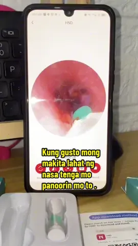 Hightech na pang tanggal ng tutuli sa tenga dahil makikita natin ang tenga natin hanggang eardrum . #visualearpick 