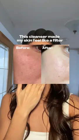 I always hear how important double cleansing is and now I BELIEVE YOU TikTok!  This oil foam cleanser changed the appearance and feel of my skin in one week. #maxclinic #maxclinicoilfoamcleanser #skintone #brightening #complexion #glassskin #eoeopartners 