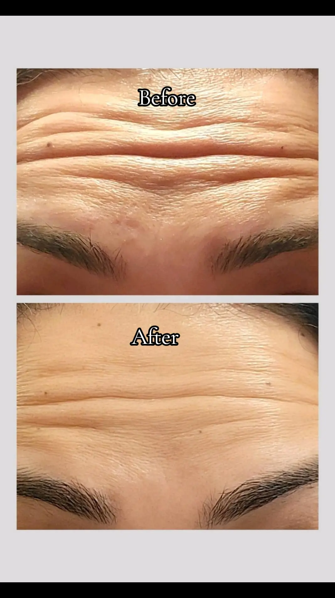 No gimmicks needed when you follow a consistent and intentional skincare routine. #antiaging  #skincareroutine @Depology 