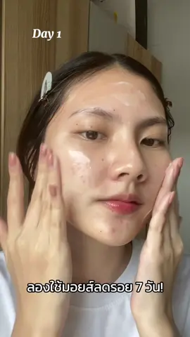 ยิ่งใช้คู่กับตัวเซรั่มยิ่งเห็นผลไว ผิวดีขึ้นมากกก เลิฟสุดๆๆ🥹💗 #skintific #บอกต่อ #ลดรอยสิว 