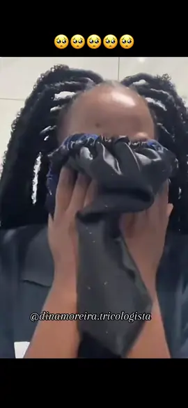 🥺 NÃO FAÇAM POR FAVOR🙏🏾 #trancas #trancasapertadas #alopeciaportracão #cuidadoscomcabelo #dicasdecabelo #dinamoreiratricologista #tricologista #tricologia #tricologialuanda #tricologiaangola #fyp 