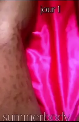 kit vergetures très très efficace comme vous le voyez #vergetures #stretchmarks #fyp #videoviral #500kviews #trending #tiktokidofficial 