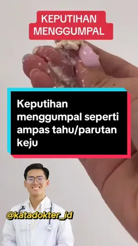 Keputihan menggunpal seperti amas tahu/parutan keju bukalah kondisi normal. #keputihan #keputihanabnormal #keputihanbau #keputihangatal 