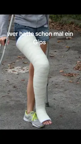 #longlegcast #llc #gip #cast #lac #longarmcast 