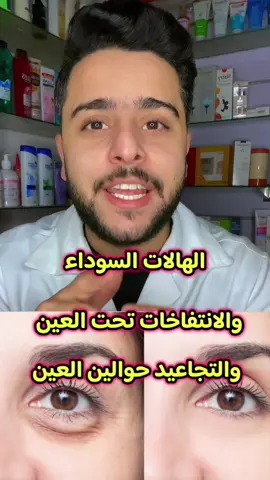 وصفة السحر لعلاج الهالات السوداء حوالين العين وكمان بتعالج الانتفاخات والتجاعيد حوالين العين #الهالات_السوداء_تحت_العين #الهالات_السوداء #هالات_سوداء #تجاعيد_تحت_العيون #انتفاخات_تحت_العين #eyecare #darkcirclesundereyes #darkcirclestreatment #tiktoksalon #وصفات_طبيعية #fyppppppppppppppppppppppp #fypシ 