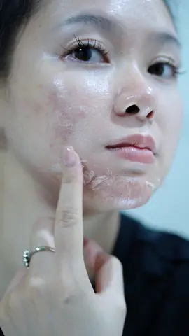 Giai đoạn yêu thích 😆 #asmr #asmrsounds #asmrvideo #peel#peellda #skincare #trieulinhhoa  