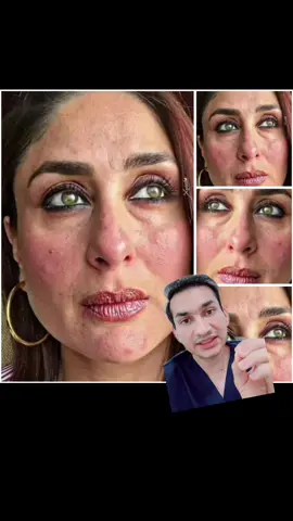 Everyone of us is beautiful in our own ways #drawaisarif #skincare #trending #beautifulskin #foryou #fyp 