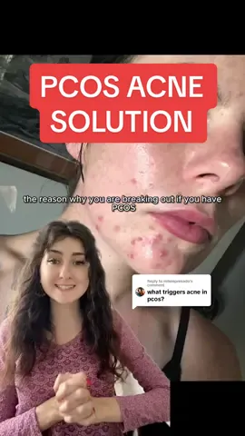 Replying to @mikeepresado  Best treatment for PCOS acne - This is how to fix acne from PCOS! THE ANTI-ACNE FORMULA course available in bio #acnetreatment #hormonalacne #hormonalacnejourney #hormonalacnesolution #acne