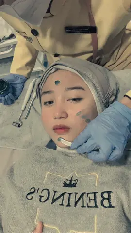 Temenin sampe cantik bukan cari yang lebih cantik. Bersama @Benings Clinic Pamekasan  #beningsclinic #beningsindonesia #beningspamekasan #xyzbca #fyp #beranda 