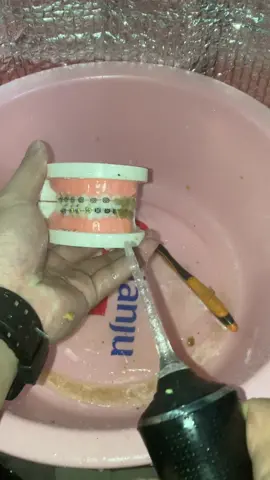 #waterflosser #fyp #gingivitis #tiktokshop #flashsale 