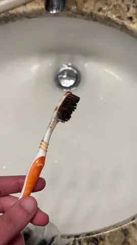 Do you have an electric toothbrush? #ttsacl #toothbrush 