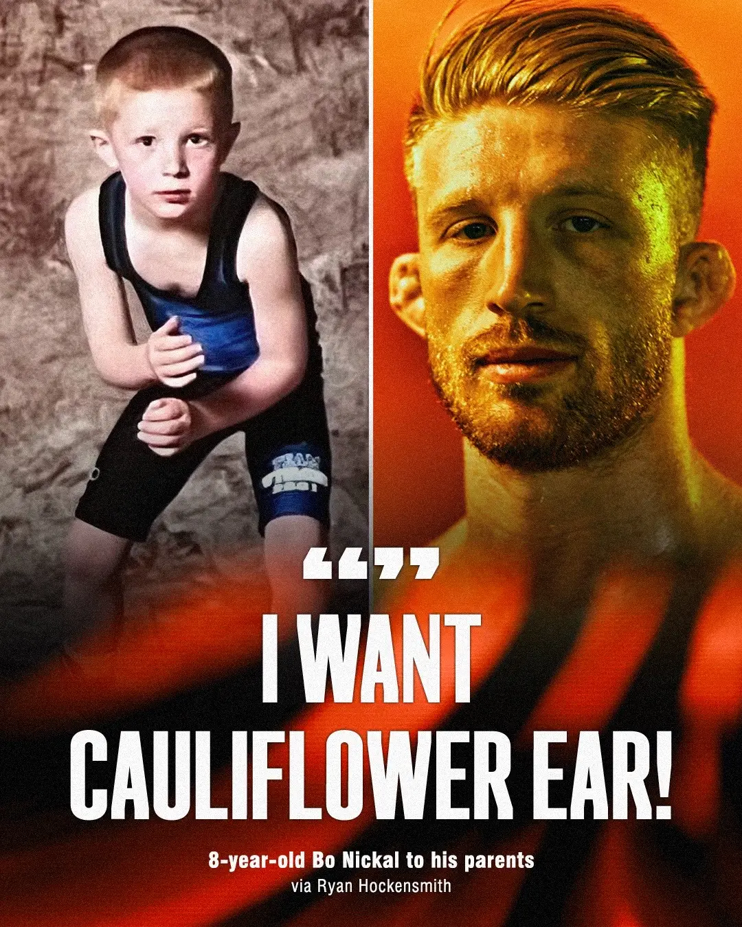Cauliflower ear: the injury fighters actually want 👊 #BoNickal spoke with Ryan Hockensmith about it ahead of #UFC300 #UFC #mma #ESPNPlus @UFC 