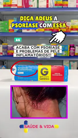 MELHOR POMADA PARA ACABAR COM A PSORIASE…🤩😱 #farmacia #drogaria #remedio #medicamentos #saude #cuidado #betametasona #pomada #psoriase #psoriasis #dermatitis #foryou #viral #viraltiktok #trending  @Saúde e Vida 