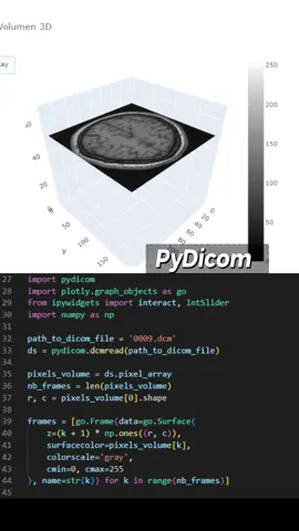 Pydicom facilita la manipulación y análisis de imágenes médicas en formato DICOM. #dicom #medicina #python #programacion 