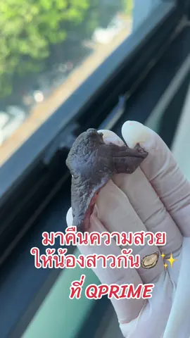 มาตัดตกแต่ง ให้น้องสาวสวยกัน😍#รีแพร์คิวคลินิก #qclinic #qprime #เลเบียคิวคลินิก #ศัลยกรรมน้องสาว #รีวิวศัลยกรรม #ศัลยกรรมตกแต่งน้องสาว #ศัลยกรรมน้องสาวคิวคลินิก #หมอโบนัสคิวคลินิก 