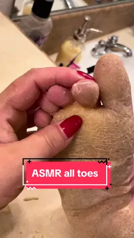 Audio-only all toes ✌️ #parmeseanpalms #callusremoval 