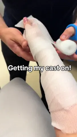 Getting my cast on! #cast #brokenbone #brokenarm 