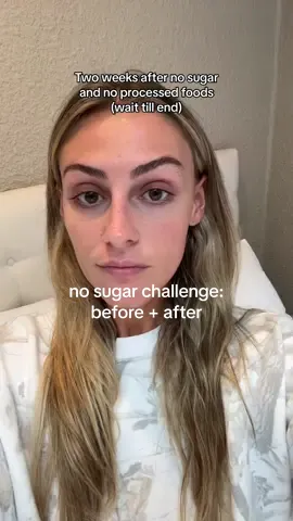 I’ve been doing the no added sugar diet since January, but broke it for a little and went back to doing it two weeks ago 👀👀👀 I took a bunch of before videos on March 30th because I knew I was going to have a slimmer face, reduced inflammation and clearer skin if I stuck to it fully 🫶🏻 best decision ever doing no sugar — let me know what questions you have!! video creds: @Michaela #nosugar #weightloss #sweettreats #skinny 