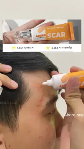 តើគ្រីមព្យាបាលស្លាកស្នាមណា ដែលមានលើកទិញច្រើននិងការវាយតម្លៃល្អដូច្នោះ? #abera #scar #skincare #scarremoval