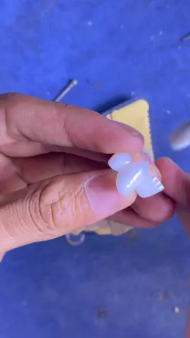 Bà chị đi làm răng yêu cầu làm khểnh. Xong về 2 ngày sau dẫn lên 2 đứa em nữa thế là 3 chị em ai cũng khểnh 😁🥰 #hoars #xuhuong #nhakhoa #ctyphuchinhrangsuthammythienphuoc