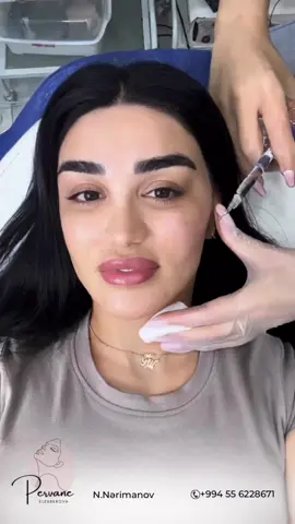 Biorevotalozant qocalmanın elehine zamanı geri dönderen bir prosedur. 🌟 🌟 🌟 #biorevitalizant #hekimkosmetoloqbaku  