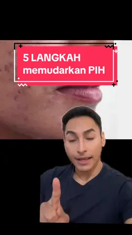 Monggo cek @ABOVEBOARD SKINCARE kl mau hehe. Perlu dicatat dalam pemilihan produk semua tetap kembali ke formulasinya serta kecocokan & kondisi kulit kalian. Jadi gaada syarat yg mutlak ya disini #skincare #fyp #bekasjerawat #pih #hyperpigmentation #kusam #cerah #brightening #sunscreen #serum #aha #exfoliation #eksfoliasi #retinol #retinoid #tretinoin #edukasi #education #educational #notsponsored 