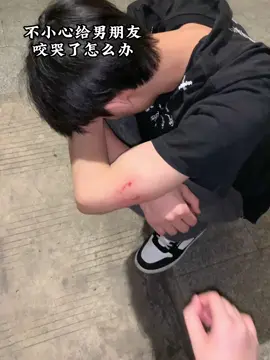 Phải làm sao khi lỡ cắn người yêu cái như vậy🤪#yangg #yang #douyin #couple #ngontinh 