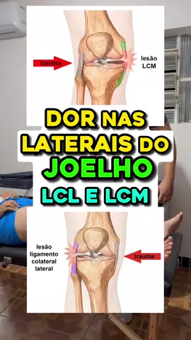 Dor nas laterais do joelho? esse teste é para saber se você tem lesão ou frouxidão nos ligamentos colaterais do joelho, colateral lateral e medial (LCL/LCM) #ligamentocolateralmedial #ligamentocolaterallateral #joelho #dornojoelho #ligamentodojoelhorompido #lesaonojoelho 