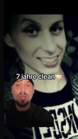 Das ist robin vor ca 7 jahren….. mein leben war nicht immer einfach.. und das ist es bis heute nicht. Aber die fortschritt, die man gemacht hat, sollte man nie vergessen.. ❤️❤️❤️❤️❤️