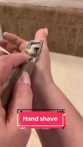 #onthisday shaving my non-dominant hand w/@FOOTLOGIX callus softener 🥰 #parmeseanpalms #callusremoval #dermatologist 