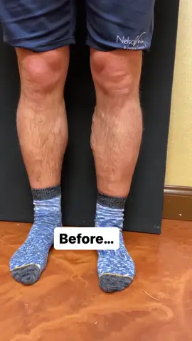 Loving his legs!!!  It’s your turn to love the way your legs look and feel!! Met your deductible?  Then there is no time like the present to take care of you and your legs! Call 440-617-6061 to schedule an appointment, or visit NelsonVein.com to request a consultation 24/7.   #nelsonvein #loveyourlegs #varicoseveins #varicoseveintreatment #legswelling #metdeductible #insurance  #venousinsufficiency  #now #wow #veins #deductible #learnmore #sclerotherapy #microphlebectomy #venousinsufficiency #venousreflux #spiderveins #veintreatment #beforeandafter 